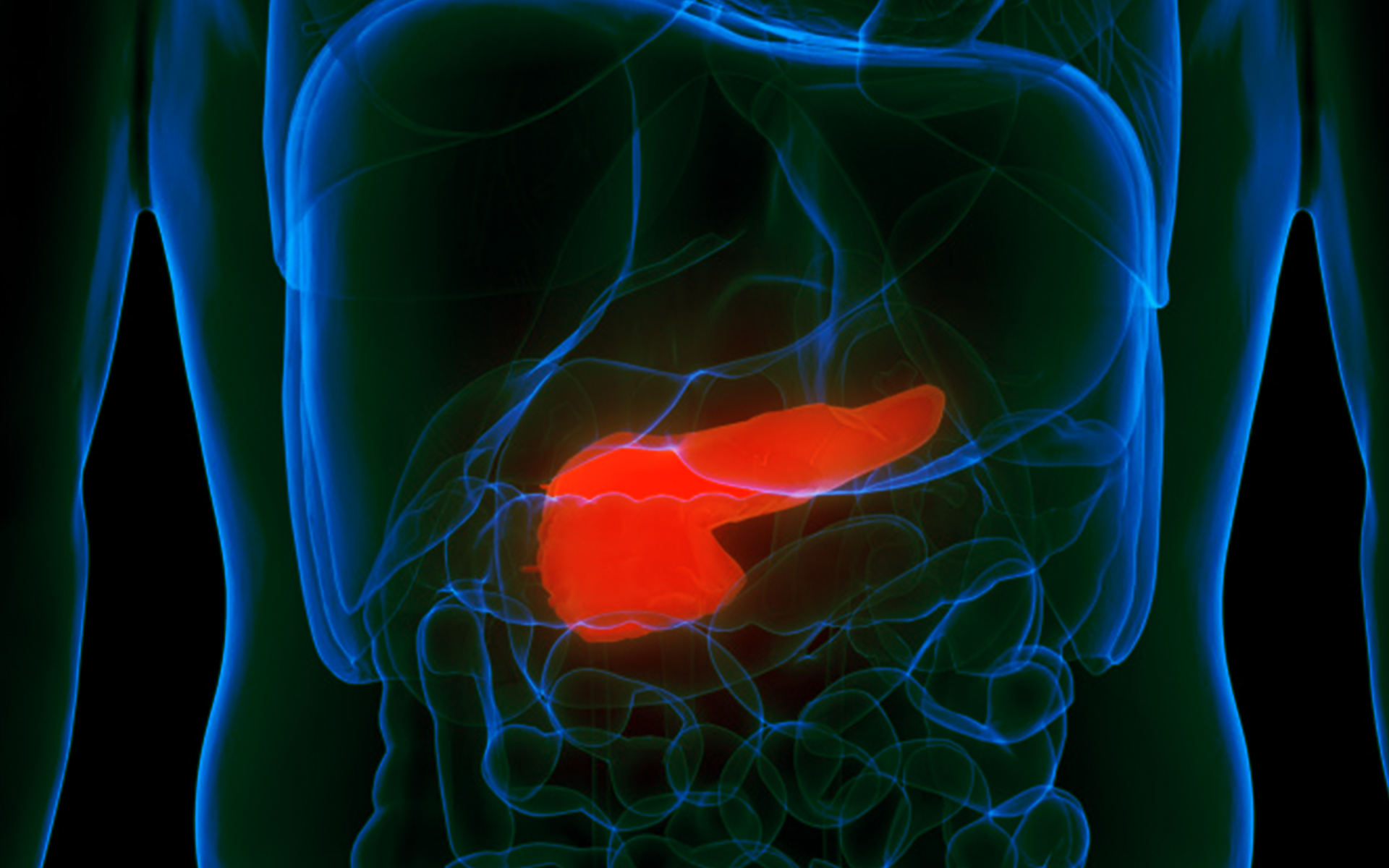 Dxcover’s Scientists Publish on Early-Stage Detection of Pancreatic Cancer